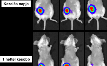 HUN-REN: új lendületet adhat a rák elleni harcnak a magyar kutatók fejlesztése